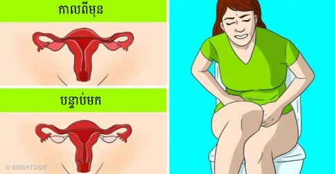 សូមកុំឲ្យកើតមាន!!! សញ្ហាព្រមានទាំង ៨ នៃការអស់រដូវដែលអ្នកប្រហែលជាមិនចាប់អារម្មណ៍