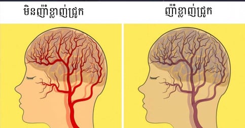 យោងតាមការសិក្សា អាហារ ១២ ប្រភេទ ដែលមានឥទ្ធិពលលើ សរសៃប្រសាទរបស់អ្នក