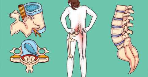 A Surgeon Reveals Exercises That Can Heal Your Spine Before It’s Too Late