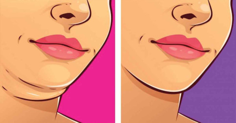 8 Exercises to Lose Chubby Cheeks and Get a Defined Face