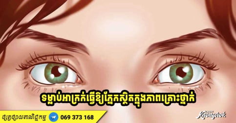 ទម្លាប់មិនល្អប្រចាំថ្ងៃទាំងនេះ អាចធ្វើឱ្យភ្នែកទាំងគូររបស់អ្នក ស្ថិតក្នុងភាពគ្រោះថ្នាក់-v2