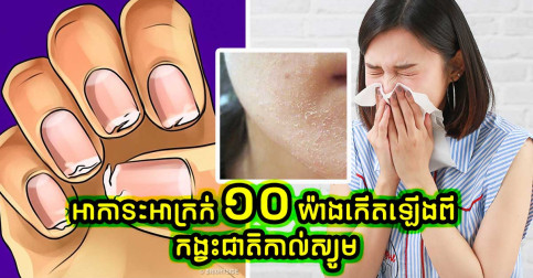 យល់ដឹង៖ ហានិភ័យ ១០ យ៉ាងដែលបណ្តាលមកពី​ កង្វះជាតិកាល់ស្យូម
