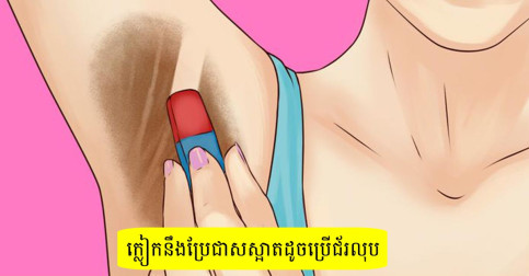 ៦ វិធីបែបធម្មជាតិបំបាត់ស្នាមជាំ អុជខ្មៅនៅលើក្លៀក សស្អាតដូចប្រើជ័រលុប-v2