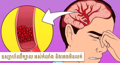 ឧស្សាហ៍ឈឺក្បាល អស់កំលាំង និងគេងមិនលក់ សូមចាប់ផ្តើមទទួលទានអាហារទាំងនេះ!-v2