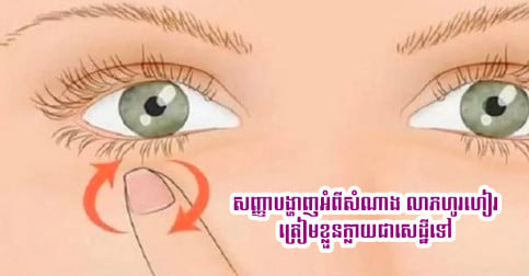 លេចចេញសញ្ញាទាំង៤នៅលើរាងកាយ បង្ហាញថា អ្នកកំពុងតែមានសំណាង លាភហូរចូលបន្តបន្ទាប់ ត្រៀមខ្លួនក្លាយជាសេដ្ឋីបានហើយ