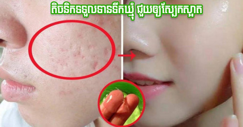 សាមញ្ញមិនចំណាយច្រើន! នេះតិចនិកទទួលទានទឹកឃ្មុំ ប្រើពេលតែ ១ សប្តាហ៍ អាចបានស្បែកស្អាតដូចនារីកូរ៉េ