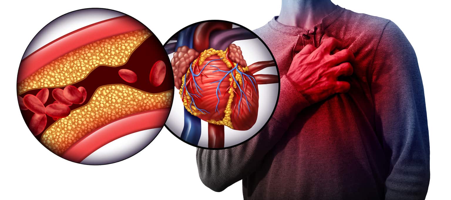 What Is Cholesterol