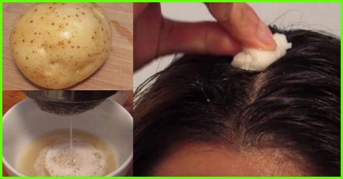 How To Use Potato Juice For Hair Growth 1