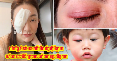 ឈប់ច្រឡំទៅមិនមែនមកពីមើលឆ្កែធ្វើអីគ្នាទេ! នេះមូលហេតុពិតដែលនាំឲ្យកើតពពែឆ្កែ និងវិធីព្យាបាល
