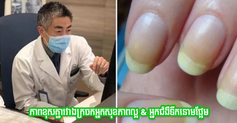 ច្រើនគ្នាហើយកើតទឹកនោមផ្អែមដោយមិនដឹងខ្លួន! នេះវេជ្ជបណ្ឌិតប្រាប់ពីវិធីសង្កេតមើលតាមរយៈក្រចក
