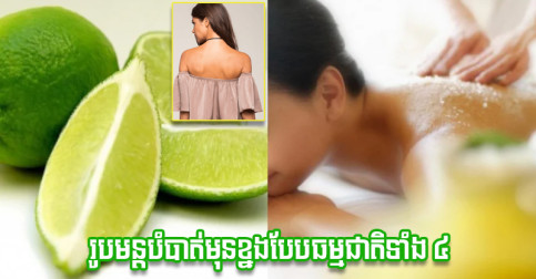 គ្មានភាពជឿជាក់នឹងពាក់អាវវាលខ្នង? នេះរូបមន្តធម្មជាតិបំបាត់មុនខ្នងទាំង ៤ ដែលអ្នកគួរដឹង