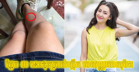 អ្នក​ខ្លះ​ថា​អាក្រក់​មើល តែ​អត់​ដឹង តាមពិត​ផ្នែក​ទាំង​ ៣ លើ​ដង​ខ្លួន​ស្ត្រី បើ​ដុះ​ក្រាស់ឃ្មឹក​គឺ​ជា​សញ្ញា​អាយុ​វែង​ទៅ​វិញ​ទេ