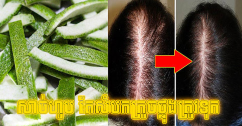 សាច់​ហូប តែ​សំបក​ក្រូចថ្លុង​ត្រូវ​ទុក ​ព្រោះ​អាច​ផ្តល់​ប្រយោជន៍​ធំ ២ មិន​សូវ​មាន​អ្នក​ដឹង