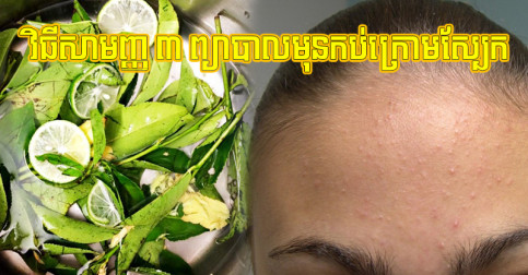 លែង​បារម្ភ​មុន​កប់​ក្រោម​ស្បែក ប្រើ​តែ​វិធី​សាមញ្ញ ៣ អាច​ឃើញ​ប្រសិទ្ធភាព​ពិតៗ