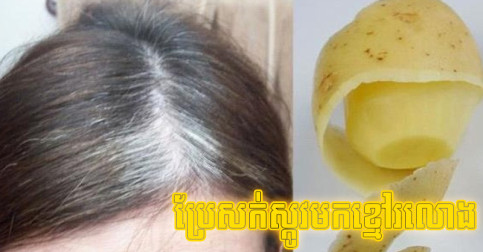អត់​ដែល​ដឹង​សោះ! រូបមន្ត​ធម្មជាតិ ប្រើ​សំបក​ដំឡូង​បារាំង ប្រែ​សក់​ស្កូវ​ឲ្យ​មក​ជា​ខ្មៅ​រលោង