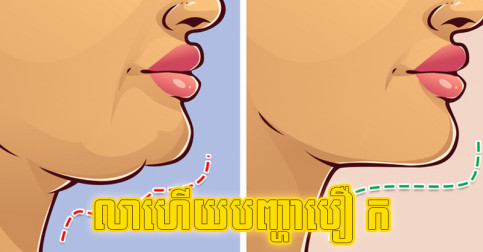 លា​ហើយ​បញ្ហា​កបឿ អនុវត្ត​តែ​វិធី​សាមញ្ញ ៥ នេះ យក​ប្រសិទ្ធភាព​ទៅ​ណា​អស់