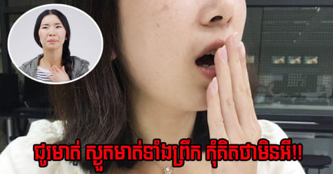 កុំ​គិត​ថា​មិន​អី! ភ្ញាក់​ព្រឹក​ឡើង​មាត់​ស្ងួត​ ជូរ​មាត់ អ្នក​ប្រហែល​ជា​មាន​ជំងឺ ១ ក្នុង​ចំណោម ៥ នេះ
