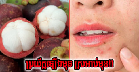 មិន​សុទ្ធ​តែ​ល្អ​ទាំង​អស់​ទេ! ផ្លែ​ឈើ ៤ នេះ​កុំ​លូក​ច្រើន​ពេក ប្រយ័ត្ន​កើត​មុន​ពេញ​មុខ