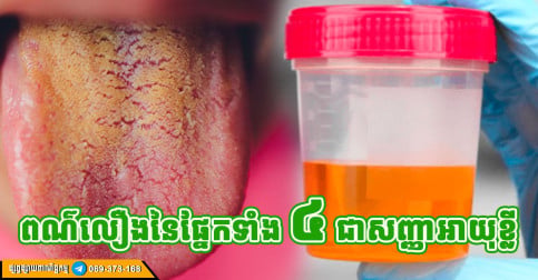 ៤ ផ្នែកនៃរាងកាយ ដែលមានពណ៌លឿង បង្ហាញថា អ្នកមានជំងឺ អាយុខ្លី
