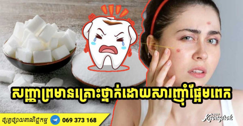 សញ្ញាព្រមាន! គ្រោះថ្នាក់ទាំង ៥ ដោយសារអាហារមានជាតិស្ករ ឬផ្អែមខ្លាំងហួសកម្រិតពេក