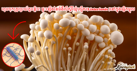 ហូបចុកត្រូវប្រុងប្រយ័ត្នបន្តិច! ផ្ទុះឡើងនៃជំងឺលីស្តឺរីយ៉ូហ្សុីស(Listeriosis )នៅក្នុងផ្សិតម្ជុល