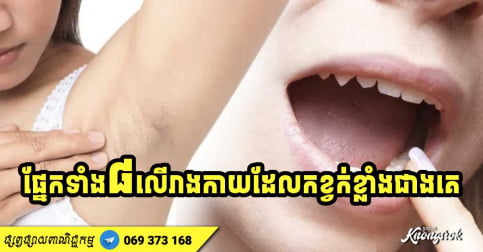 ផ្នែកទាំង ៨ នៅលើរាងកាយ ដែលមានភាពកខ្វក់ខ្លាំងជាងគេបំផុត ដែលគ្រប់គ្នានឹកស្មានមិនដល់