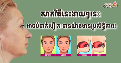 សាកវិធីនេះងាយៗនេះ អាចបំបាត់បឿ ក បានយ៉ាងមានប្រសិទ្ធិភាព!