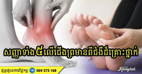 សញ្ញា​ទាំង​ ៥ ​នៅ​ជើង​ព្រមាន​ពី​ជំងឺ​ដ៏​គ្រោះថ្នាក់​៖ អ្នក​ដែល​គ្មានសញ្ញាទាំងនេះសូមអបអរសាទរ
