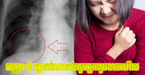 បើ​ចេញ​សញ្ញា​ ៥ នេះ​មក​ ច្បាស់​ណាស់​សួត​អ្នក​កំពុង​រង​ការ​ខូចខាត​យ៉ាង​ធ្ងន់ធ្ងរ