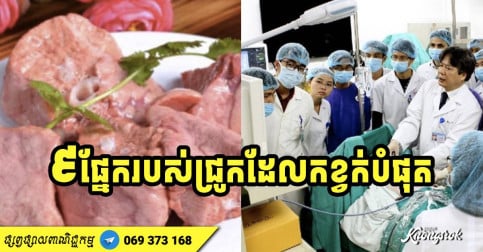 កុំលូកល្អ! ៩ ផ្នែករបស់ជ្រូកដែលកខ្វក់បំផុត ញ៉ាំកាន់តែតិចកាន់តែល្អ ចៀសវាងបង្កគ្រោះដល់ខ្លួន