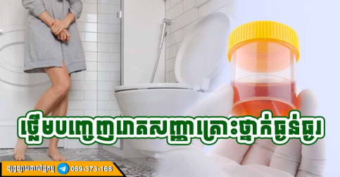 គ្រោះថ្នាក់ណាស់! មិន​ថា​ប្រុស​ ឬ​ស្រី បើ​ឃើញ​សញ្ញា​ទាំង ​៣​ នេះ​នៅពេល​ព្រឹក​ ប្រយ័ត្ន​កើត​ជំងឺ​ថ្លើម​