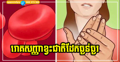 សញ្ញាធំៗមួយចំនួនដែលបង្ហាញថា អ្នកកង្វះជាតិដែក!