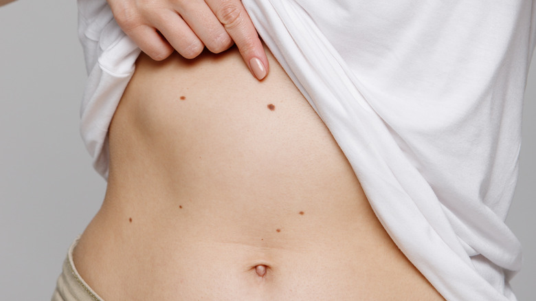 If You Have A Mole On Your Stomach Its Meaning Depends On What Side Its On 1610742489