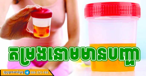 ទឹកនោមនៅពេលព្រឹក លាតត្រដាងស្ថានភាពក្រលៀន! គួរប្រយ័ត្នទាំងនេះ 