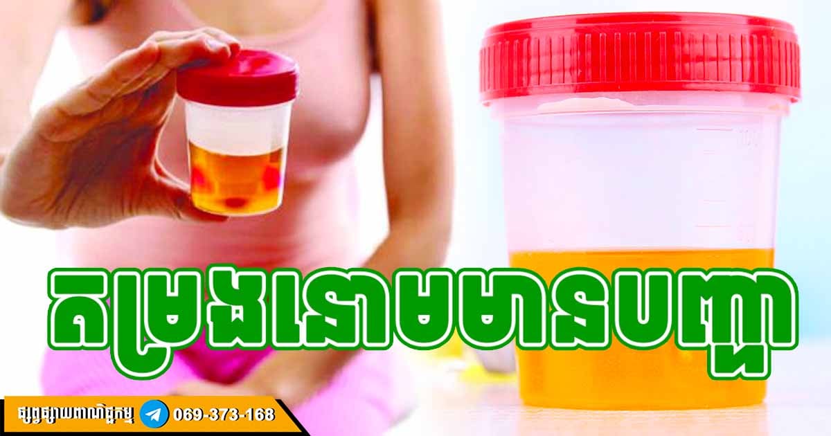 ទឹកនោមនៅពេលព្រឹក លាតត្រដាងស្ថានភាពក្រលៀន! គួរប្រយ័ត្នទាំងនេះ ទឹកនោមនៅពេលព្រឹក លាតត្រដាងស្ថានភាពក្រលៀន! គួរប្រយ័ត្នទាំងនេះ