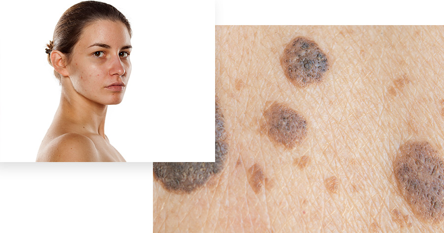Irregular B Spots 01 02