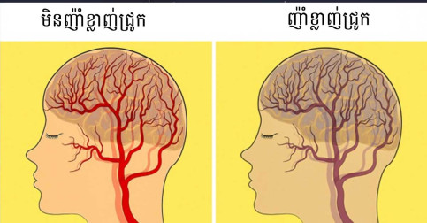 អាហារ ១២ ប្រភេទដែលមានឥទ្ធិពលលើសរសៃប្រសាទរបស់អ្នក យោងតាមការសិក្សា