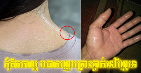 កុំគិតថាល្អ! បើឧស្សាហ៍បែកញើសនៅផ្នែករាងកាយទាំង ៤ នេះ វាជាសញ្ញាគ្រោះថ្នាក់ចំពោះសុខភាព