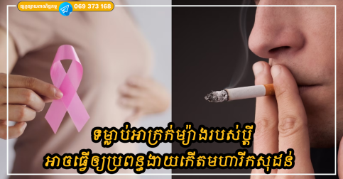 ចូរបញ្ឈប់ជាបន្ទាន់! ទម្លាប់អាក្រក់ម្យ៉ាងរបស់ប្តី អាចធ្វើឲ្យប្រពន្ធងាយកើតមហារីកសុដន់