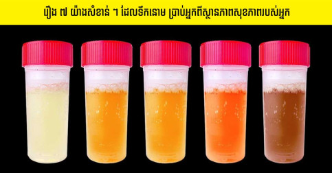 រឿង ៧ យ៉ាងសំខាន់ៗ ដែលទឹកនោមរបស់អ្នក ព្យាយាមប្រាប់អំពីបញ្ហាសុខភាពរបស់អ្នក