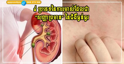 ៤ ប្រភេទនៃការរមាស់ដែលជា “សញ្ញាព្រមាន” នៃជំងឺធ្ងន់ធ្ងរ