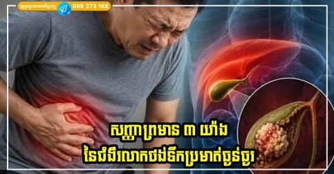 សញ្ញាព្រមាន ៣ យ៉ាងនៃជំងឺរលាកថង់ទឹកប្រមាត់ធ្ងន់ធ្ងរ