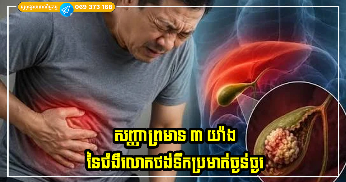 សញ្ញាព្រមាន ៣ យ៉ាងនៃជំងឺរលាកថង់ទឹកប្រមាត់ធ្ងន់ធ្ងរ សញ្ញាព្រមាន ៣ យ៉ាងនៃជំងឺរលាកថង់ទឹកប្រមាត់ធ្ងន់ធ្ងរ