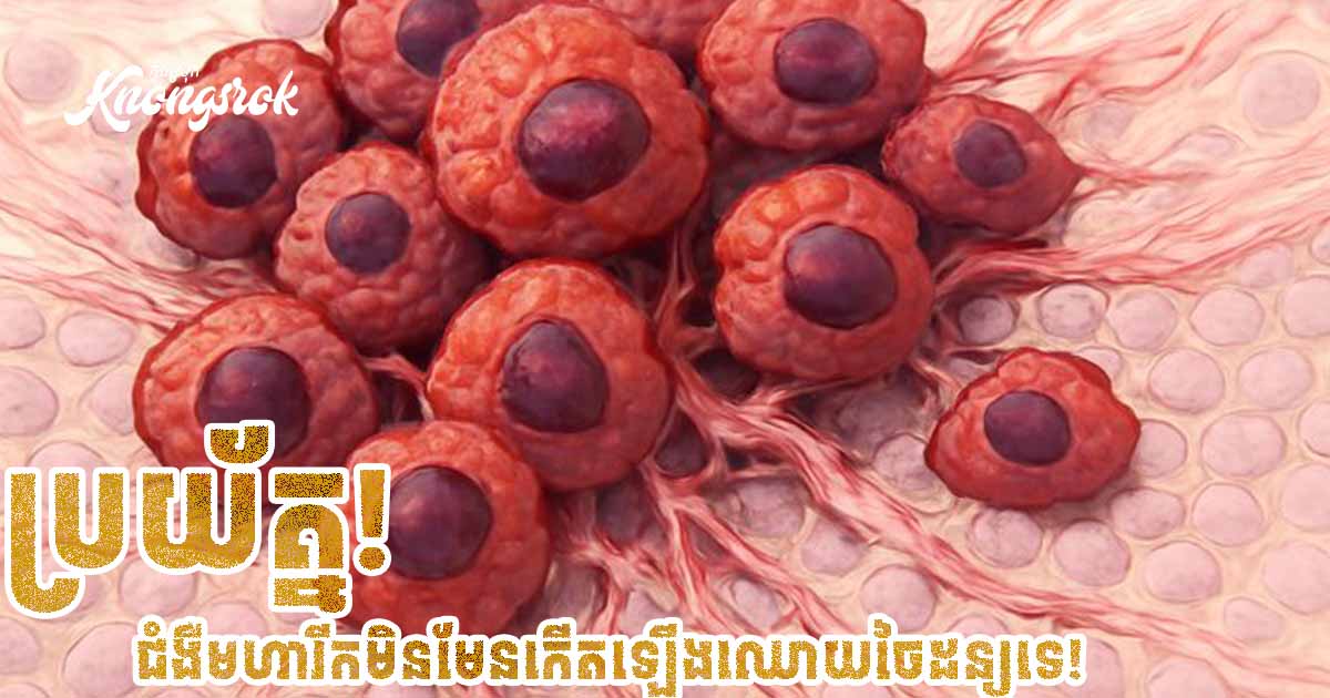 ប្រយ័ត្ន! ជំងឺមហារីកមិនមែនកើតឡើងដោយចៃដន្យទាំងស្រុងនោះទេ!! មានកត្តាជាច្រើនដែលយើងអាចគ្រប់គ្រងបាន! ប្រយ័ត្ន! ជំងឺមហារីកមិនមែនកើតឡើងដោយចៃដន្យទាំងស្រុងនោះទេ!! មានកត្តាជាច្រើនដែលយើងអាចគ្រប់គ្រងបាន!