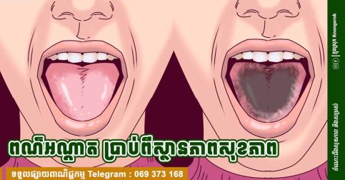 ពណ៌អណ្ដាតប្រាប់អស់! សញ្ញាសុខភាពដែលអ្នកមិនគួរមើលរំលង